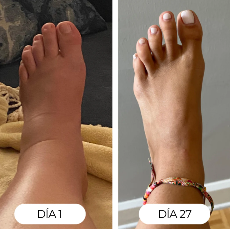 Gotas de bienestar para el drenaje linfático